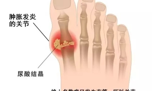 跟疱疹人同用碗筷会传染吗-与疱疹病人共用碗筷网—知名的与疱疹病人共用碗筷怎么办网站,分享与疱疹病人共用碗筷会传染吗知识